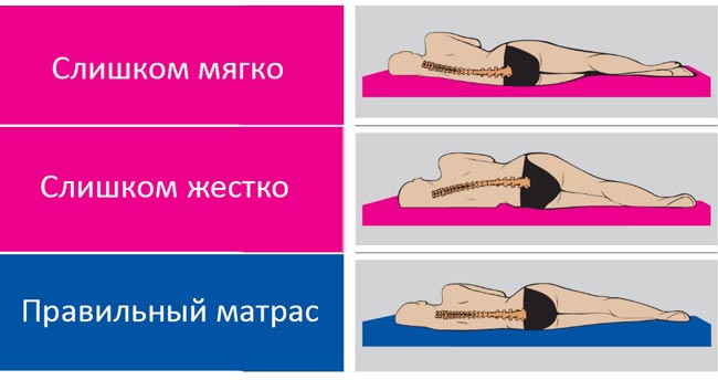 Положение спины на различных матрасах